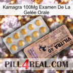Kamagra 100Mg Examen De La Gelée Orale 41